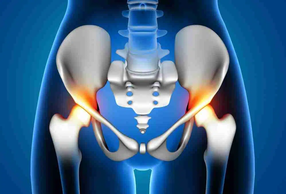 Hip And Pelvic Pain: How Do We Find The Root Cause? - One&All